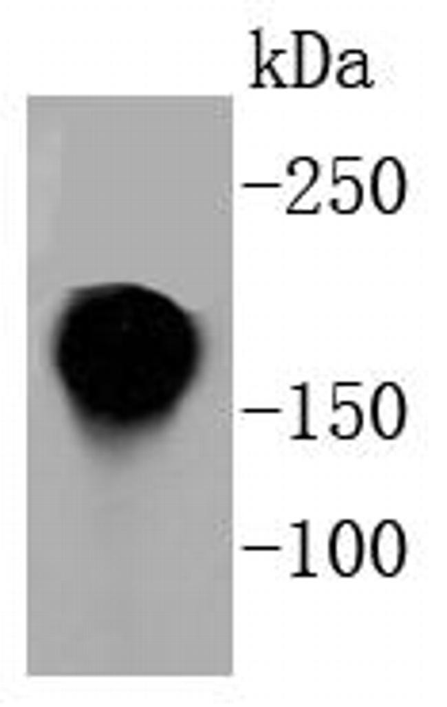 CD11a (LFA-1alpha) Antibody in Western Blot (WB)