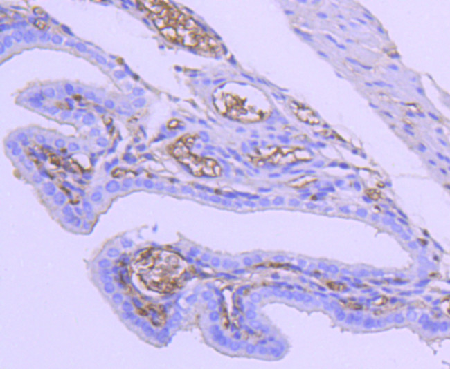 TSC2 Antibody in Immunohistochemistry (Paraffin) (IHC (P))