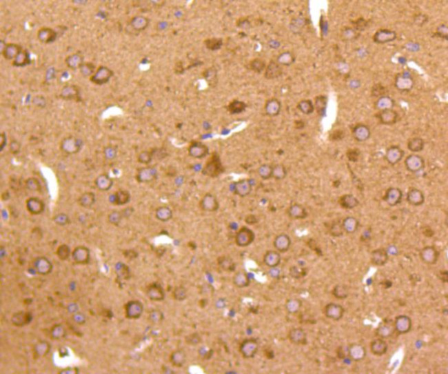 JNK2 Antibody in Immunohistochemistry (Paraffin) (IHC (P))