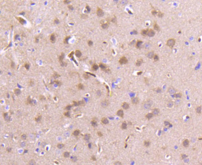 PEBP1 Antibody in Immunohistochemistry (Paraffin) (IHC (P))