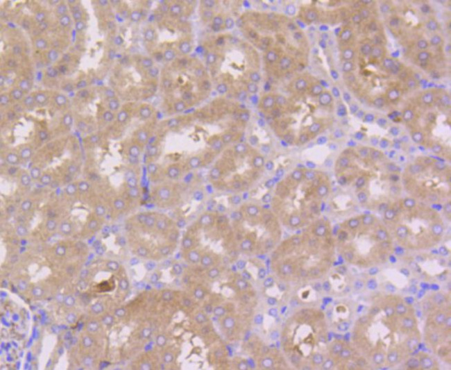 PEBP1 Antibody in Immunohistochemistry (Paraffin) (IHC (P))