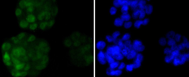 Nanog Antibody in Immunocytochemistry (ICC/IF)