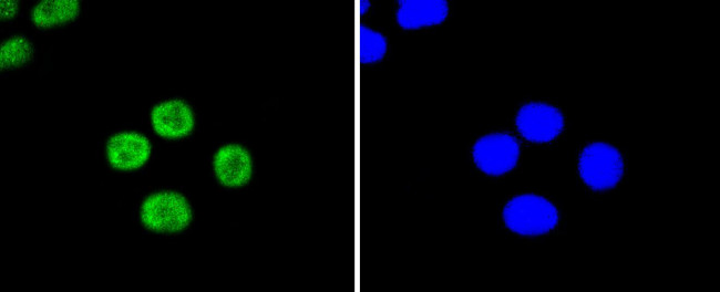 UBC9 Antibody in Immunocytochemistry (ICC/IF)