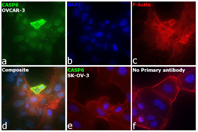 Caspase 6 Antibody in Immunocytochemistry (ICC/IF)