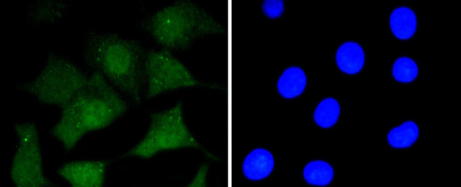 CD230 (PrP) Antibody in Immunocytochemistry (ICC/IF)