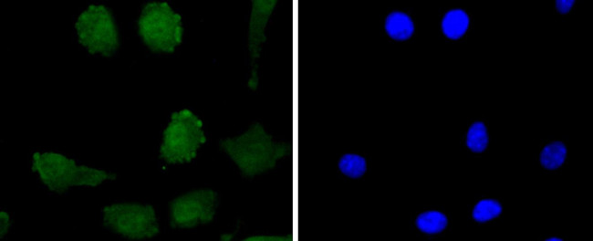 CD230 (PrP) Antibody in Immunocytochemistry (ICC/IF)