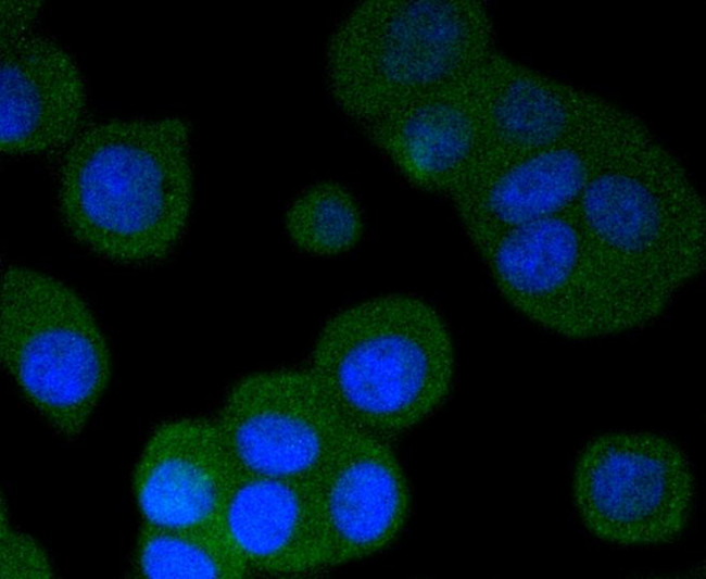 Phospho-PRKAR2A (Ser99) Antibody in Immunocytochemistry (ICC/IF)