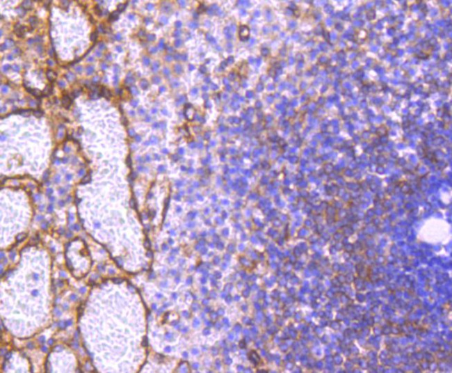 Phospho-PRKAR2A (Ser99) Antibody in Immunohistochemistry (Paraffin) (IHC (P))