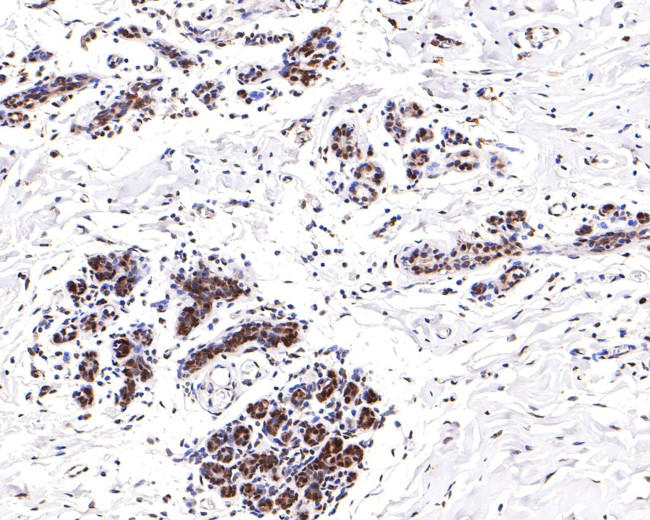 Phospho-ATF2 (Thr71) Antibody in Immunohistochemistry (Paraffin) (IHC (P))