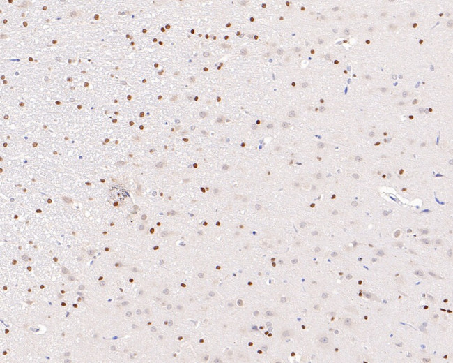 Phospho-ATF2 (Thr71) Antibody in Immunohistochemistry (Paraffin) (IHC (P))