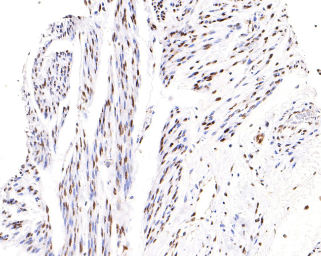 Phospho-ATF2 (Thr71) Antibody in Immunohistochemistry (Paraffin) (IHC (P))