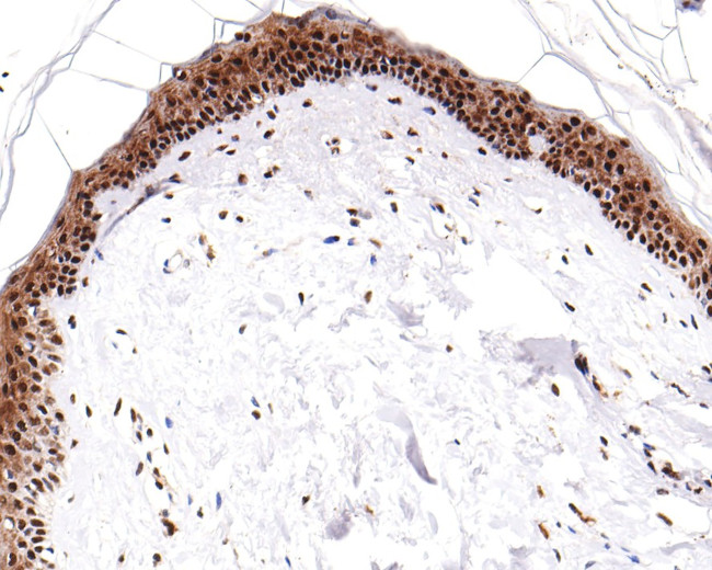 Phospho-ATF2 (Thr71) Antibody in Immunohistochemistry (Paraffin) (IHC (P))