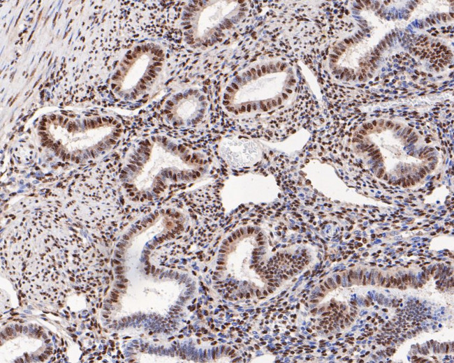 Phospho-ATF2 (Thr71) Antibody in Immunohistochemistry (Paraffin) (IHC (P))