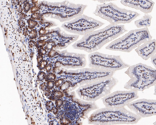 Phospho-ATF2 (Thr71) Antibody in Immunohistochemistry (Paraffin) (IHC (P))