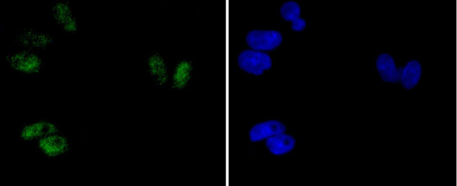 Phospho-ATF2 (Thr71) Antibody in Immunocytochemistry (ICC/IF)