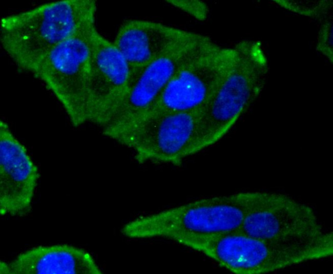 Phospho-Estrogen Receptor alpha (Ser118) Antibody in Immunocytochemistry (ICC/IF)