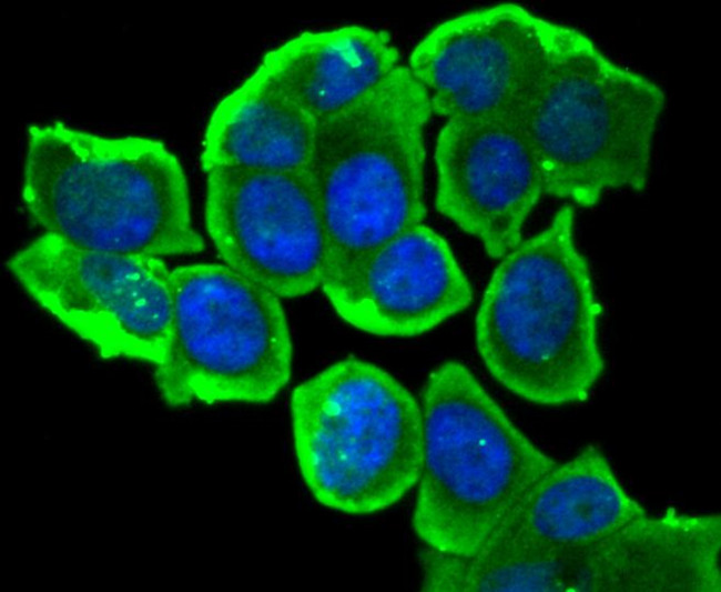 Phospho-Estrogen Receptor alpha (Ser118) Antibody in Immunocytochemistry (ICC/IF)