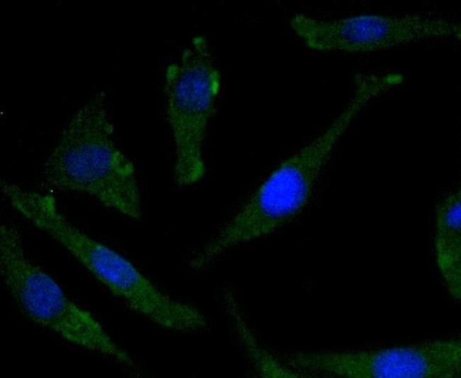 Phospho-TrkB (Tyr817) Antibody in Immunocytochemistry (ICC/IF)