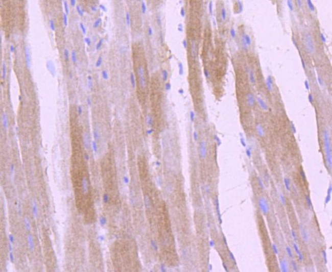 Phospho-TrkB (Tyr817) Antibody in Immunohistochemistry (Paraffin) (IHC (P))