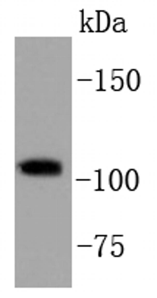 PIK3CB Antibody in Western Blot (WB)