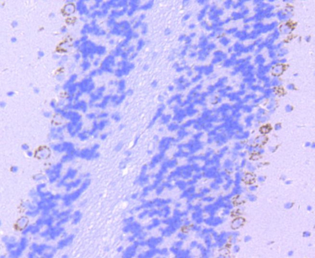 TPH1 Antibody in Immunohistochemistry (Paraffin) (IHC (P))