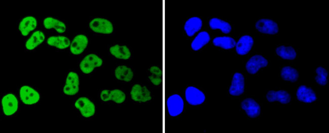 hnRNP K Antibody in Immunocytochemistry (ICC/IF)