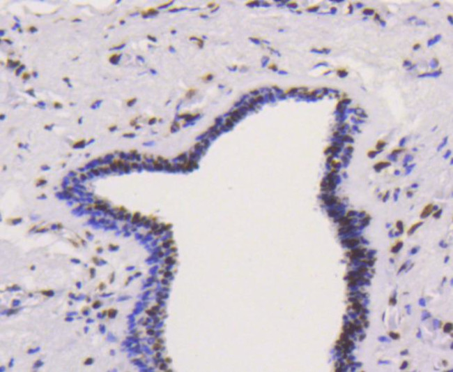 hnRNP K Antibody in Immunohistochemistry (Paraffin) (IHC (P))