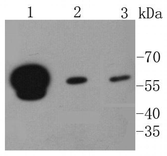 hnRNP K Antibody in Western Blot (WB)