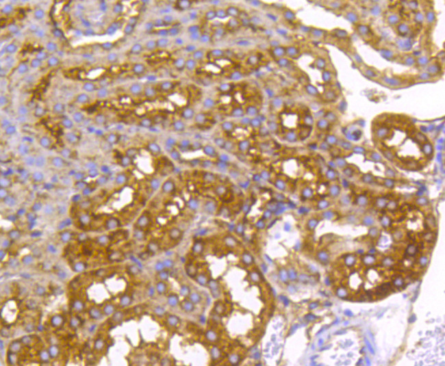 Radixin Antibody in Immunohistochemistry (Paraffin) (IHC (P))