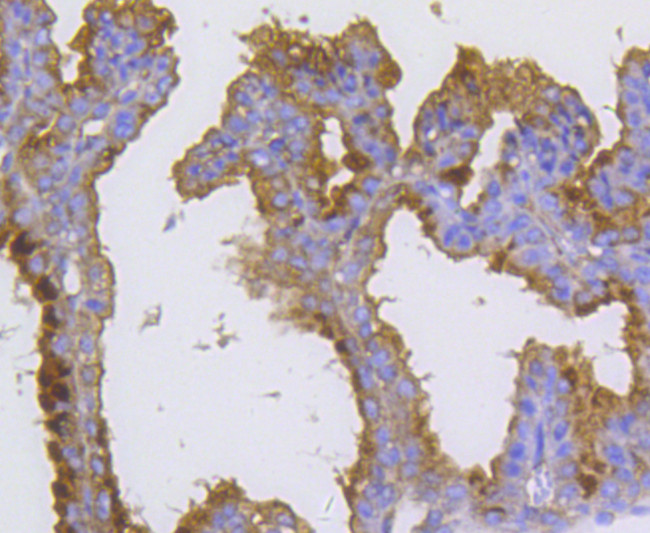 Radixin Antibody in Immunohistochemistry (Paraffin) (IHC (P))