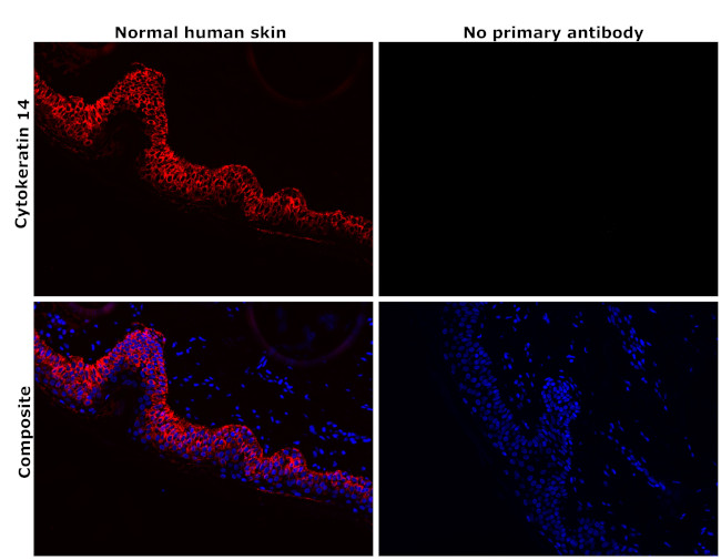 Cytokeratin 14 Antibody in Immunohistochemistry (Paraffin) (IHC (P))