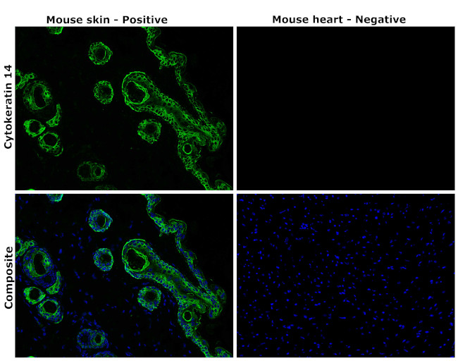 Cytokeratin 14 Antibody in Immunohistochemistry (Paraffin) (IHC (P))