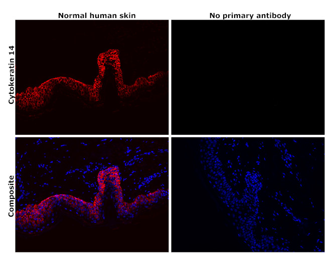 Cytokeratin 14 Antibody in Immunohistochemistry (Paraffin) (IHC (P))