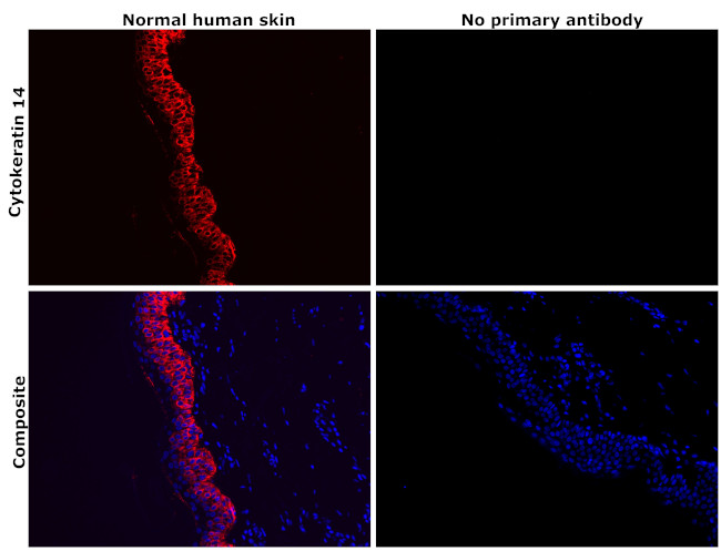 Cytokeratin 14 Antibody in Immunohistochemistry (Paraffin) (IHC (P))