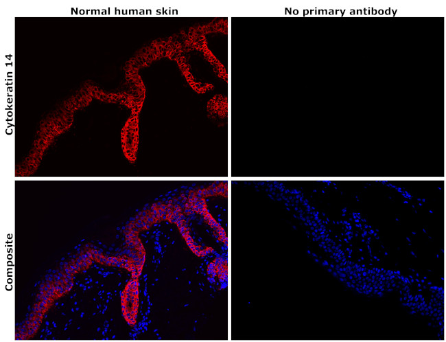 Cytokeratin 14 Antibody in Immunohistochemistry (Paraffin) (IHC (P))