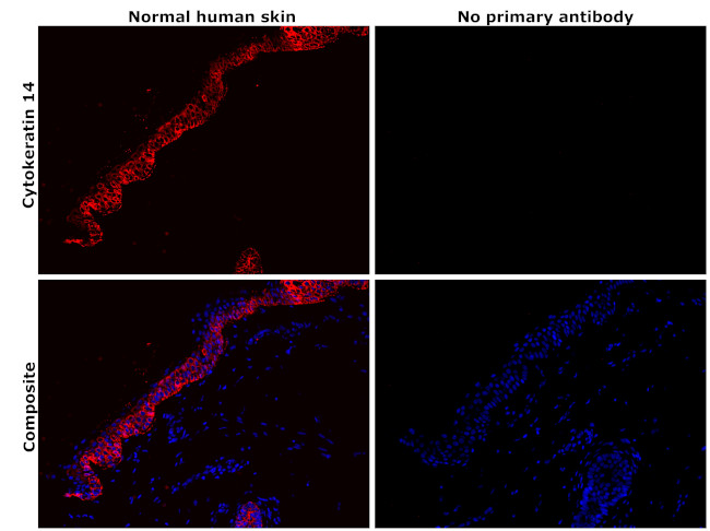 Cytokeratin 14 Antibody in Immunohistochemistry (Paraffin) (IHC (P))