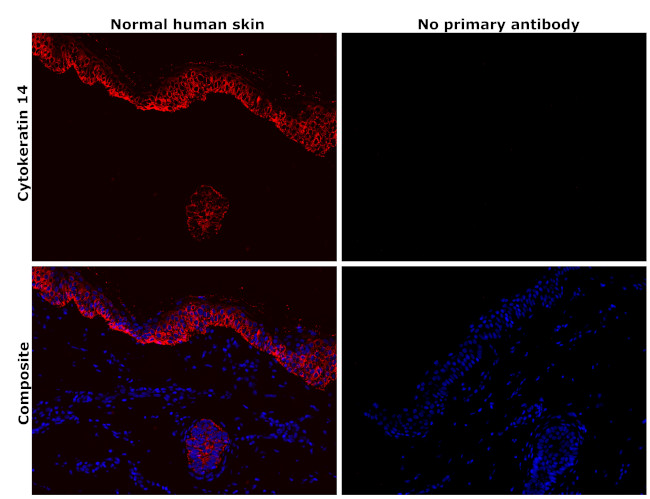 Cytokeratin 14 Antibody in Immunohistochemistry (Paraffin) (IHC (P))