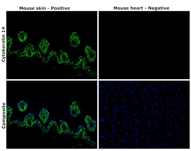 Cytokeratin 14 Antibody in Immunohistochemistry (Paraffin) (IHC (P))