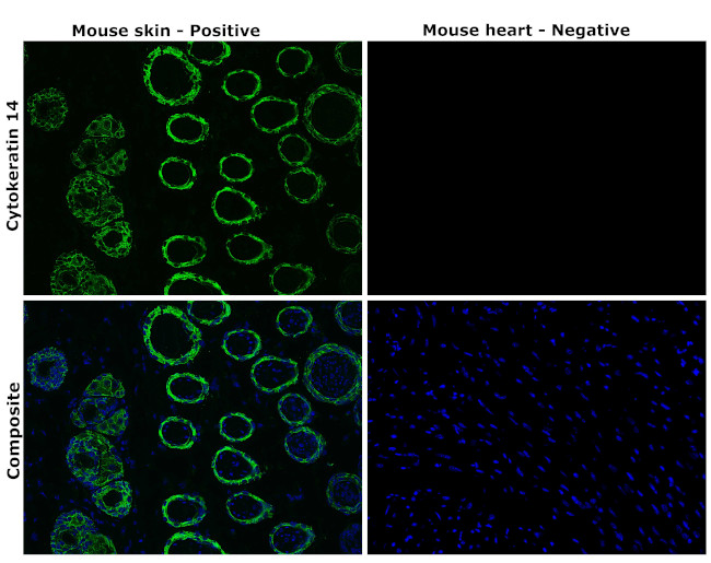 Cytokeratin 14 Antibody in Immunohistochemistry (Paraffin) (IHC (P))