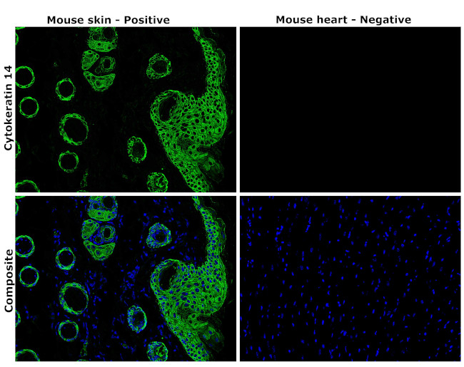 Cytokeratin 14 Antibody in Immunohistochemistry (Paraffin) (IHC (P))