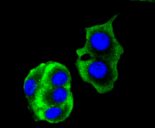 Cytokeratin 14 Antibody in Immunocytochemistry (ICC/IF)