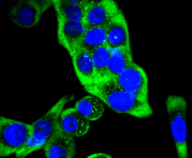 Cytokeratin 14 Antibody in Immunocytochemistry (ICC/IF)