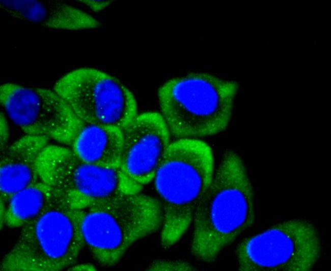 Cytokeratin 14 Antibody in Immunocytochemistry (ICC/IF)