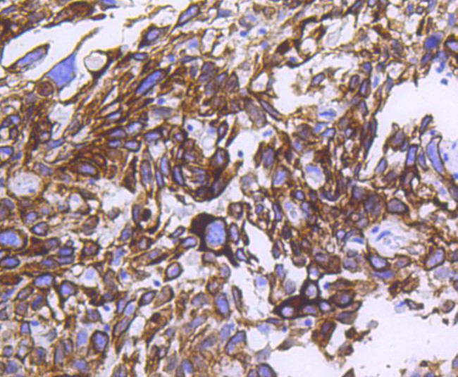 Cytokeratin 14 Antibody in Immunohistochemistry (Paraffin) (IHC (P))