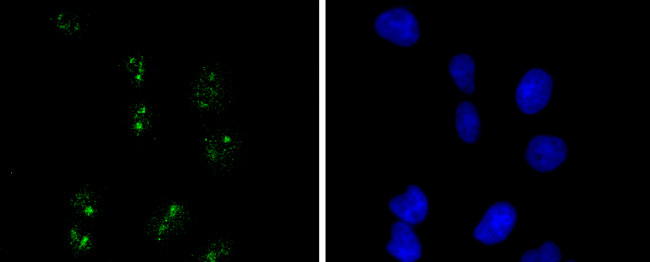 WT1 Antibody in Immunocytochemistry (ICC/IF)