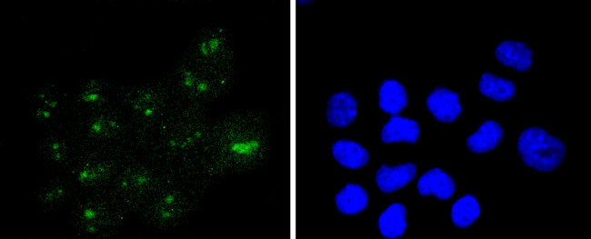 WT1 Antibody in Immunocytochemistry (ICC/IF)