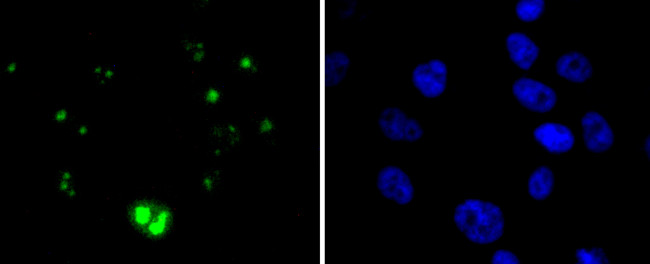 WT1 Antibody in Immunocytochemistry (ICC/IF)