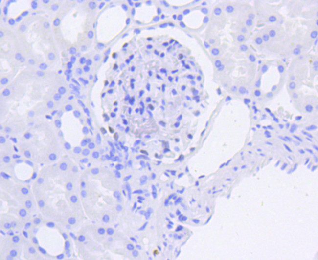 WT1 Antibody in Immunohistochemistry (Paraffin) (IHC (P))