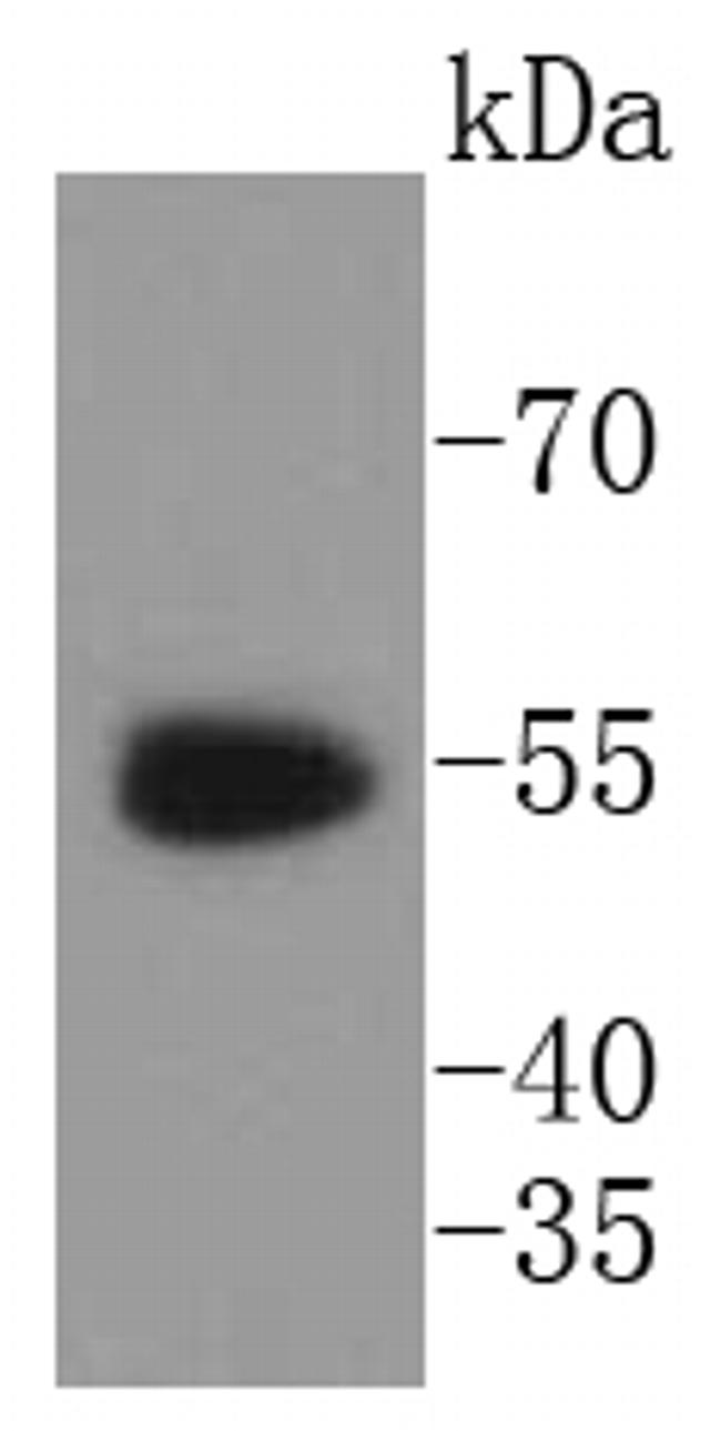 WT1 Antibody in Western Blot (WB)