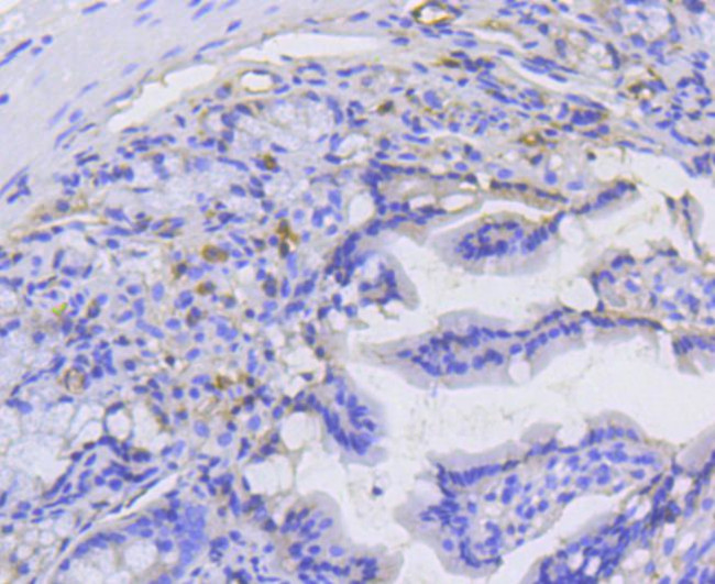 Catenin alpha-1 Antibody in Immunohistochemistry (Paraffin) (IHC (P))